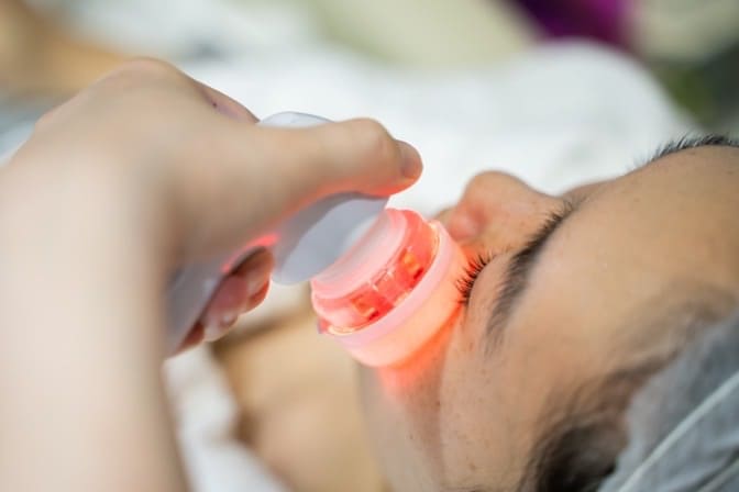 ウィッシュプロ施術イメージ